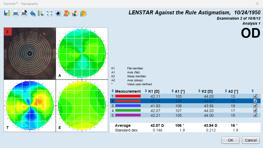 Lenstar 900 - 高精度な角膜計測 & トポグラフィー
